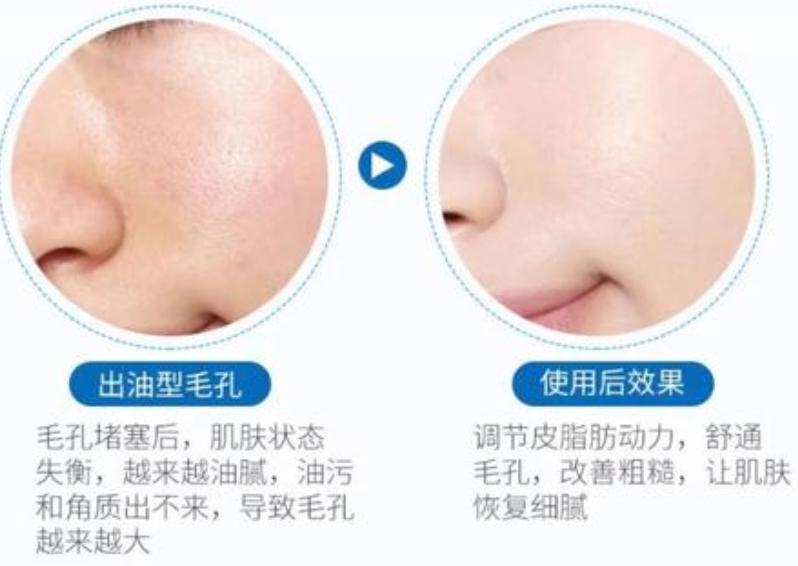 为什么海藻面膜会增大毛孔,为什么海藻面膜很便宜