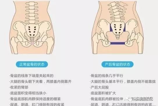 做骨盆修复是交智商税？