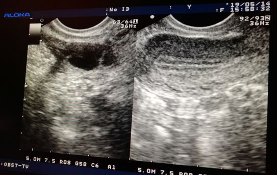 怎么才能知道什么时候排卵,怎么样才知道自己什么时候排卵