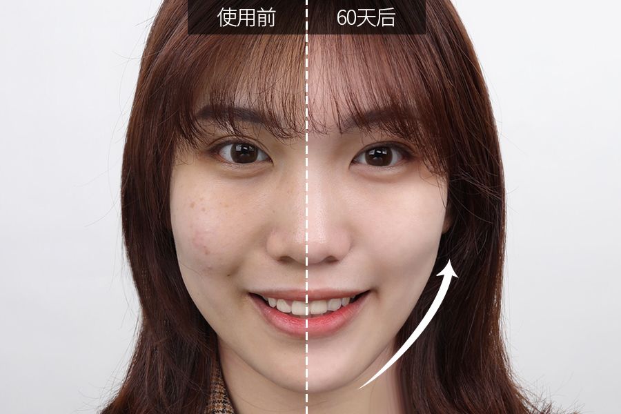 琚佸濮楁帹鑽愯憽钀勭苯鎶よ偆,琚佸濮楄憽钀勭苯绮惧崕