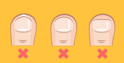 脚指甲两边向肉里扎,指甲小知识大全