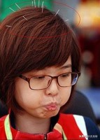 中医针灸头痛穴位图,头部经络走向图推拿手法