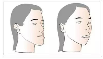 父母必看孩子教育,父母换牙需要注意什么