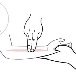 黄疸的小儿推拿手法,小儿吐奶推拿法