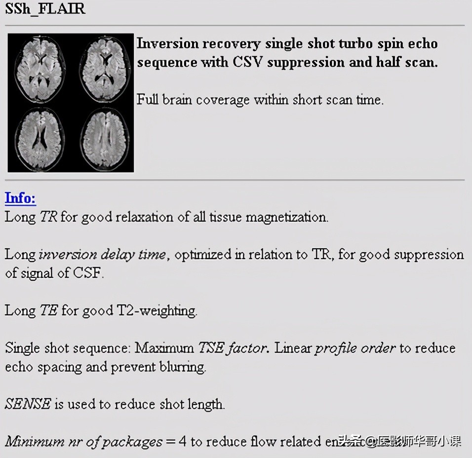 「MRI技术」磁共振伪影分析，了解下SSh_FLAIR序列