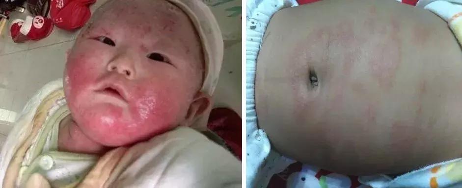 婴幼儿有必要用婴儿洗衣液吗,宝宝有没有必要用宝宝专用洗衣液