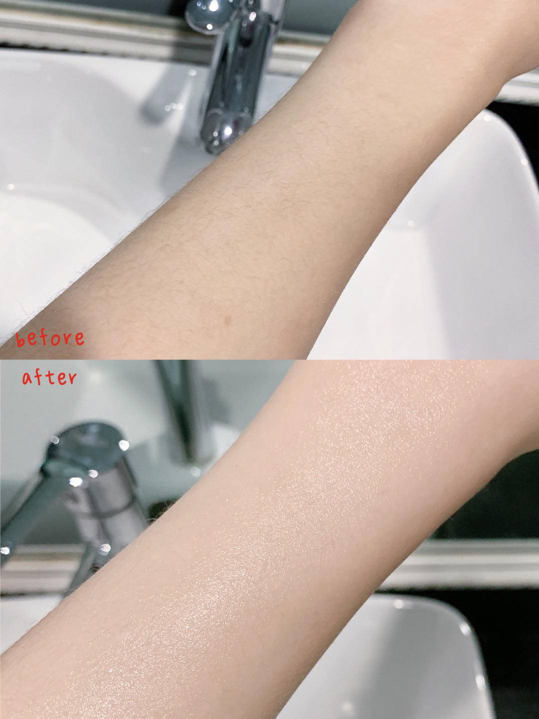 关节去黑小妙招,怎么预防关节变黑