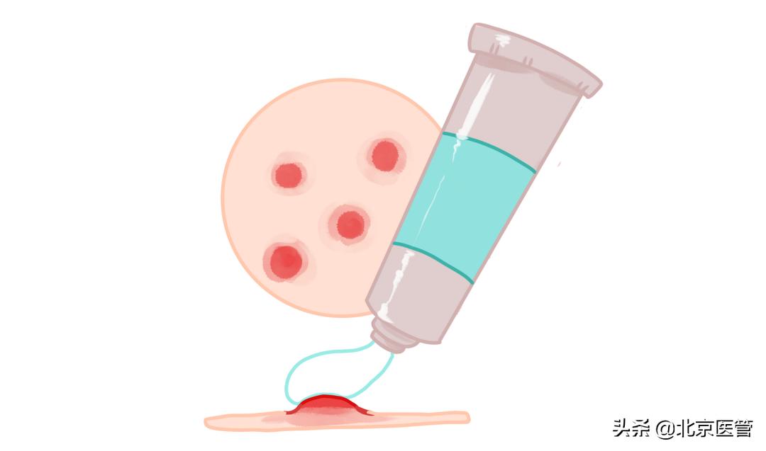 戴口罩会让痘痘更严重吗,夏天戴口罩闷出痘痘怎么办