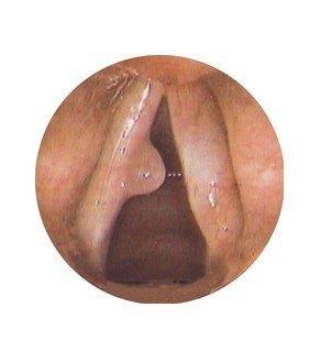 王源生病时在医院里,王源抽烟为什么影响这么大