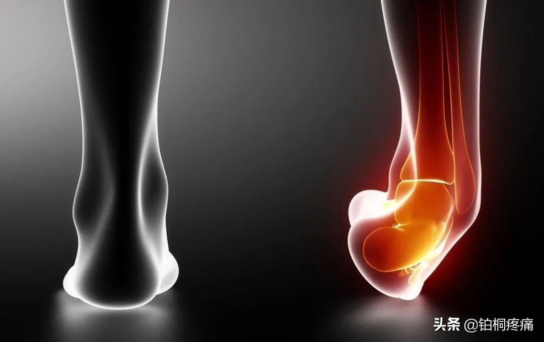 习惯性崴脚康复训练推荐动作,踝关节力量差容易崴脚吗