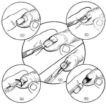 深圳龙岗区泡脚店,龙岗泡脚店