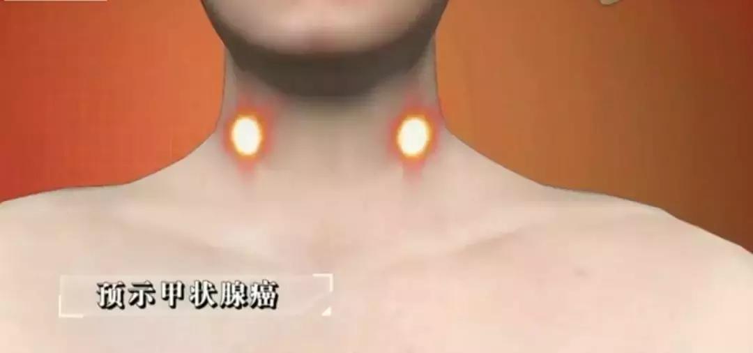 危险三角区会有什么症状,面部危险三角区有哪些危害