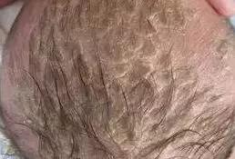 素东方科普|宝宝头上有头垢如何护理？