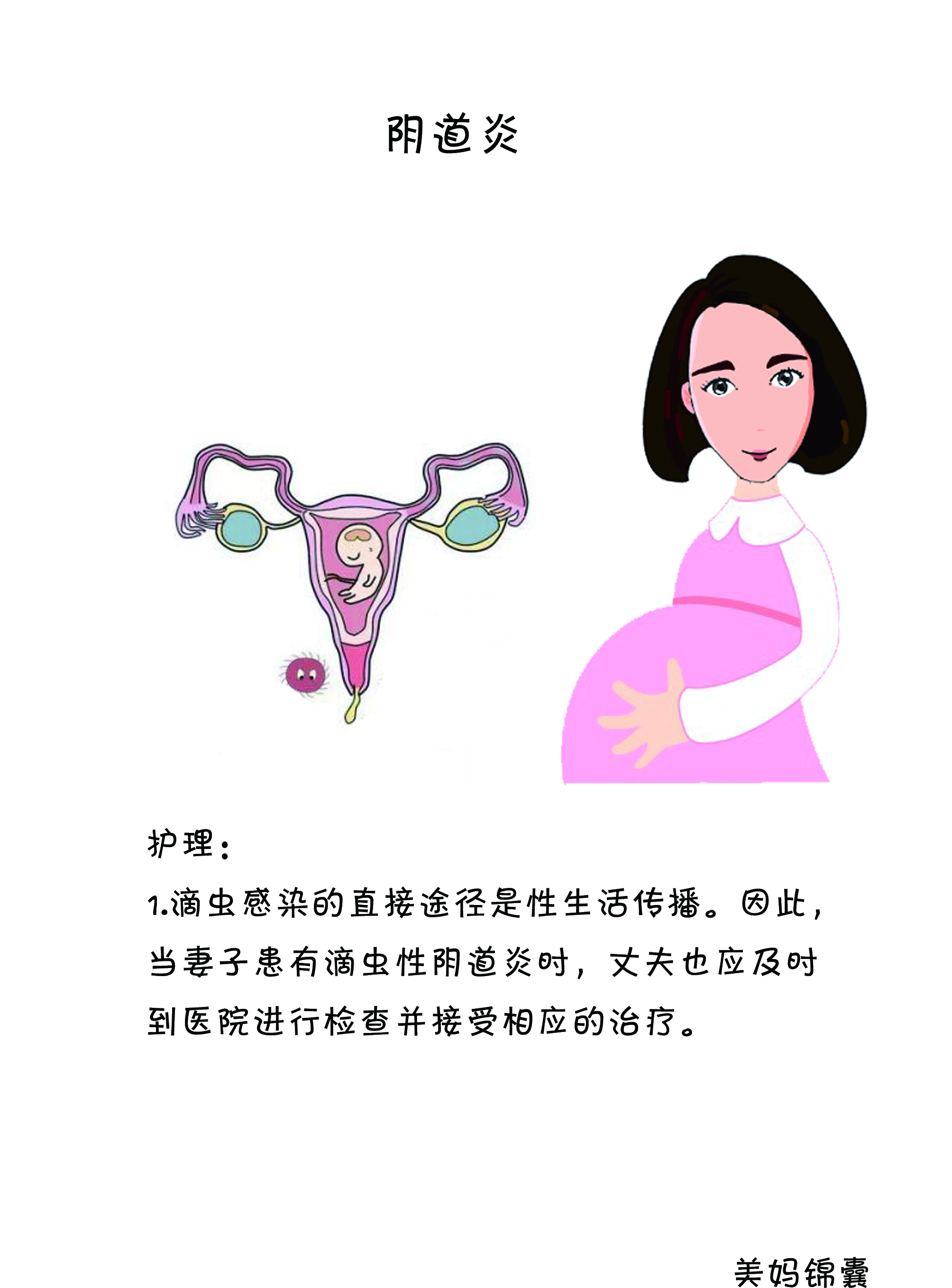 孕期阴道炎该如何护理?