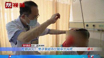 右眼皮长期跳是脑瘤,眼皮跳的频繁是颅内肿瘤的预兆吗