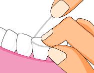 牙缝太细了能不能补一下,很小的牙缝可以补吗