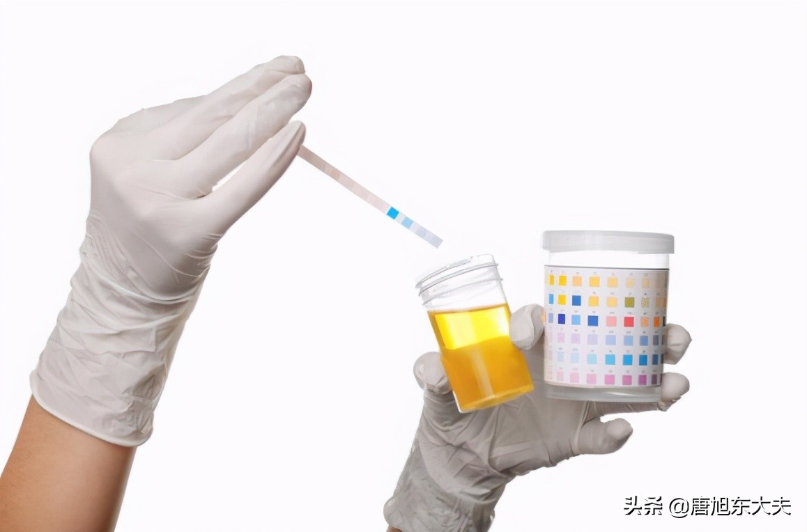 体检前这几件事不要做否则白花钱,体检前吃什么药可以影响体检结果