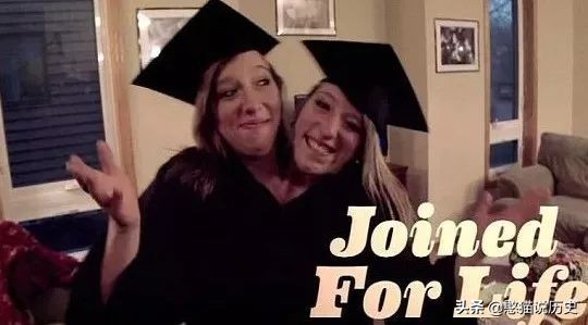 世界上最诡异的双头连体人,两个大脑如何控制同一个身躯