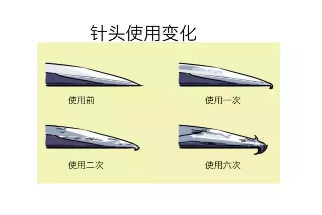 胰岛素打的疼不疼,胰岛素打起来痛