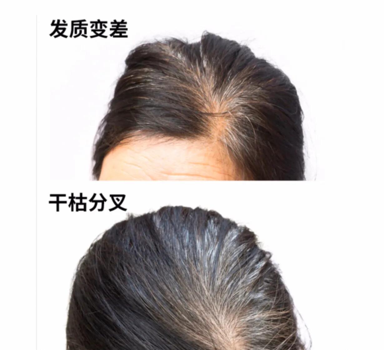 长了白头发怎么让它消失,长了白发怎么染发