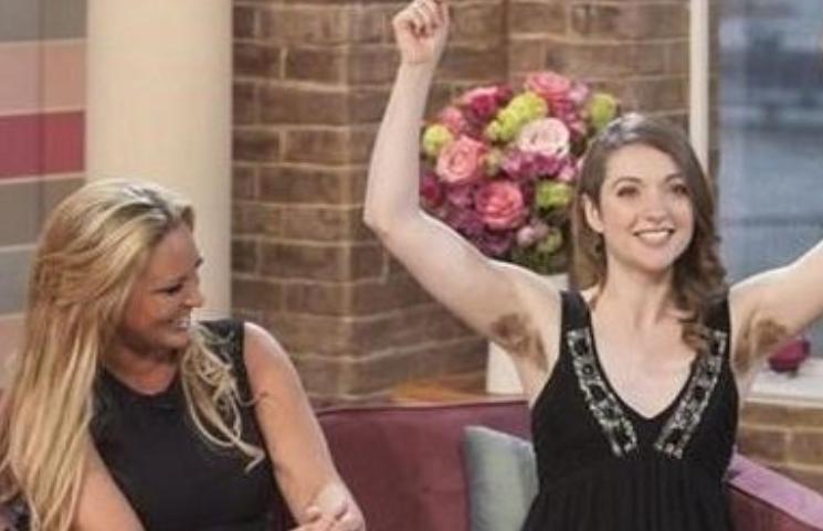 女子浑身长毛发,女子全身长毛发