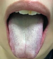 暴雨、回南天，3种舌相3道木棉花食不可错过