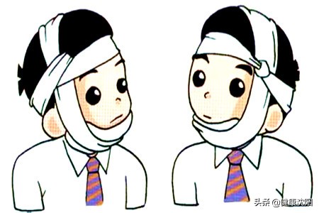 颅脑外伤治疗指南,颅脑损伤康复科普知识汇总