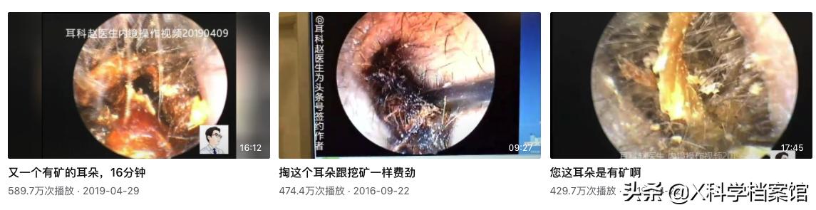 疯了!挤黑头视频7000万人看,为什么网友一边直呼恶心一边追着看