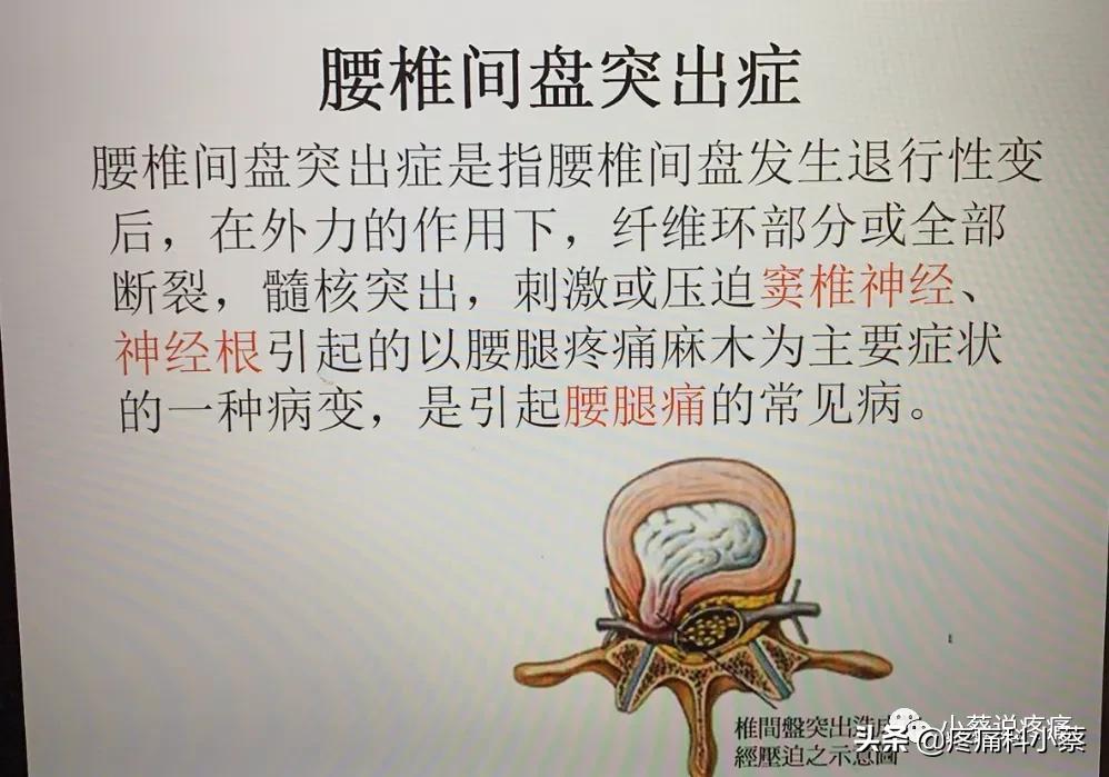 蔡主任讲座视频,蔡主任团队