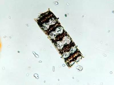 水产养殖藻类老化是怎样的,水产养殖显微镜下各种藻类