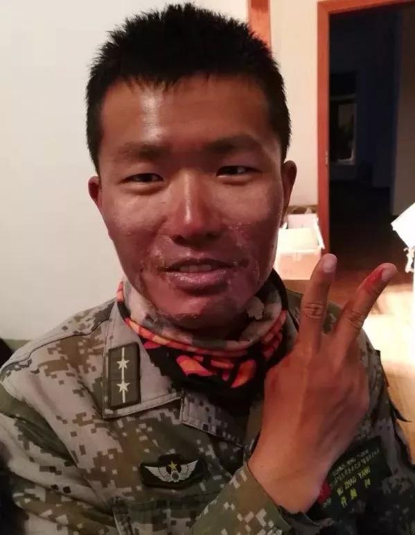 军人家属医疗免费只限军队医院吗,2022军人父母免费医疗细则