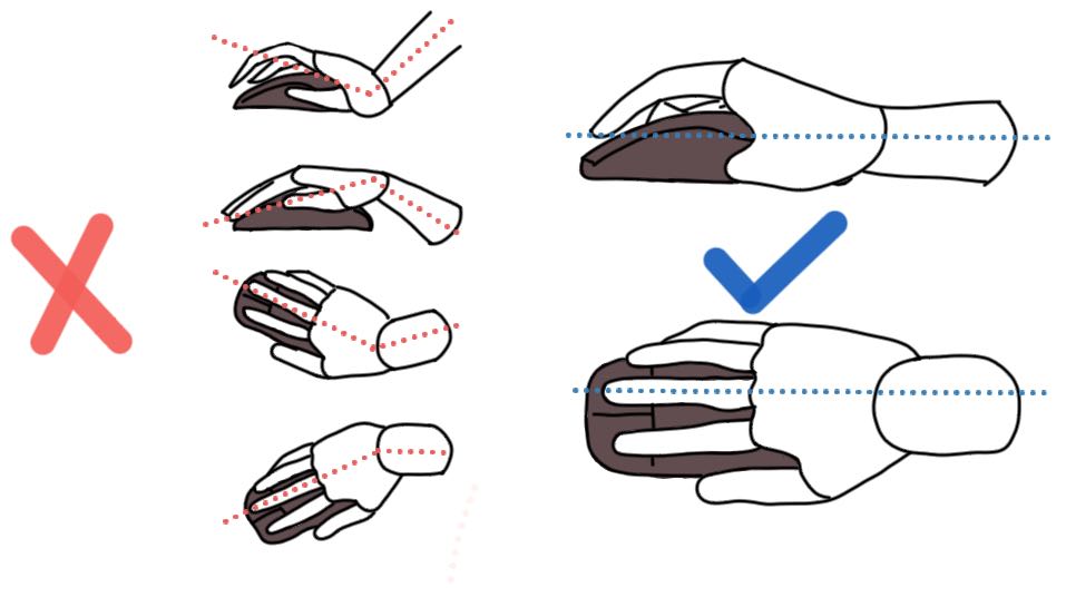 用久了鼠标手腕疼怎么办,鼠标手手腕酸痛