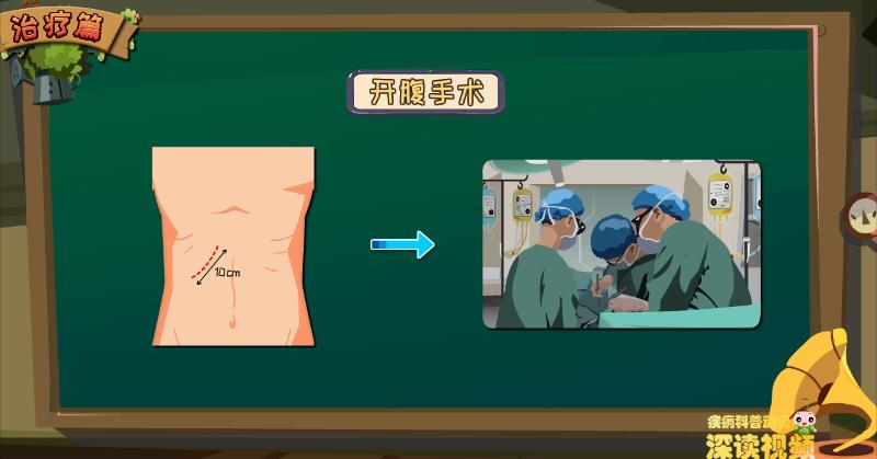 怎么样区分胆囊息肉和胆囊癌,胆囊息肉真假鉴别