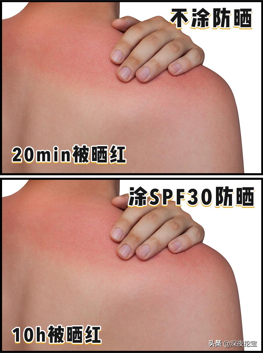 防晒推荐超强防晒晒不黑,每天被太阳晒怎么防晒不会黑
