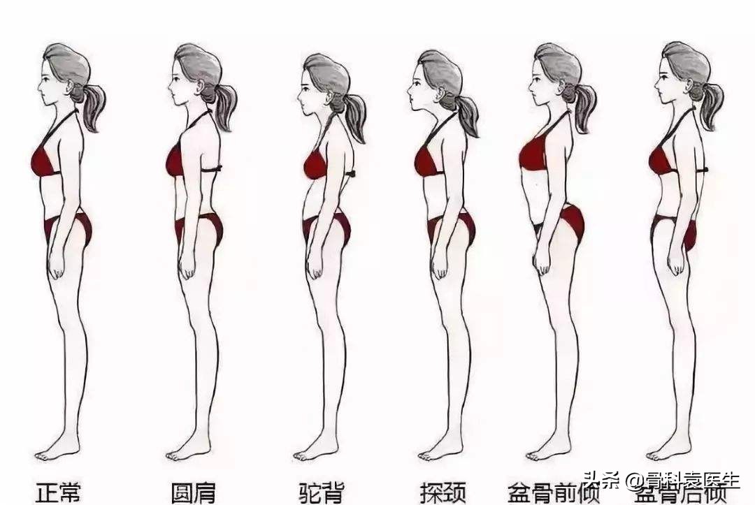 倒走真的可以治疗腰椎间盘突出吗,倒着走能治腰椎间盘突出