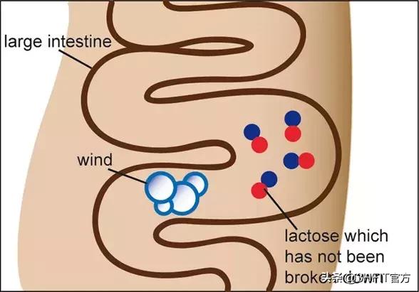 乳糖不耐受怎样才能正确判断,乳糖不耐受一般是什么情况引起的