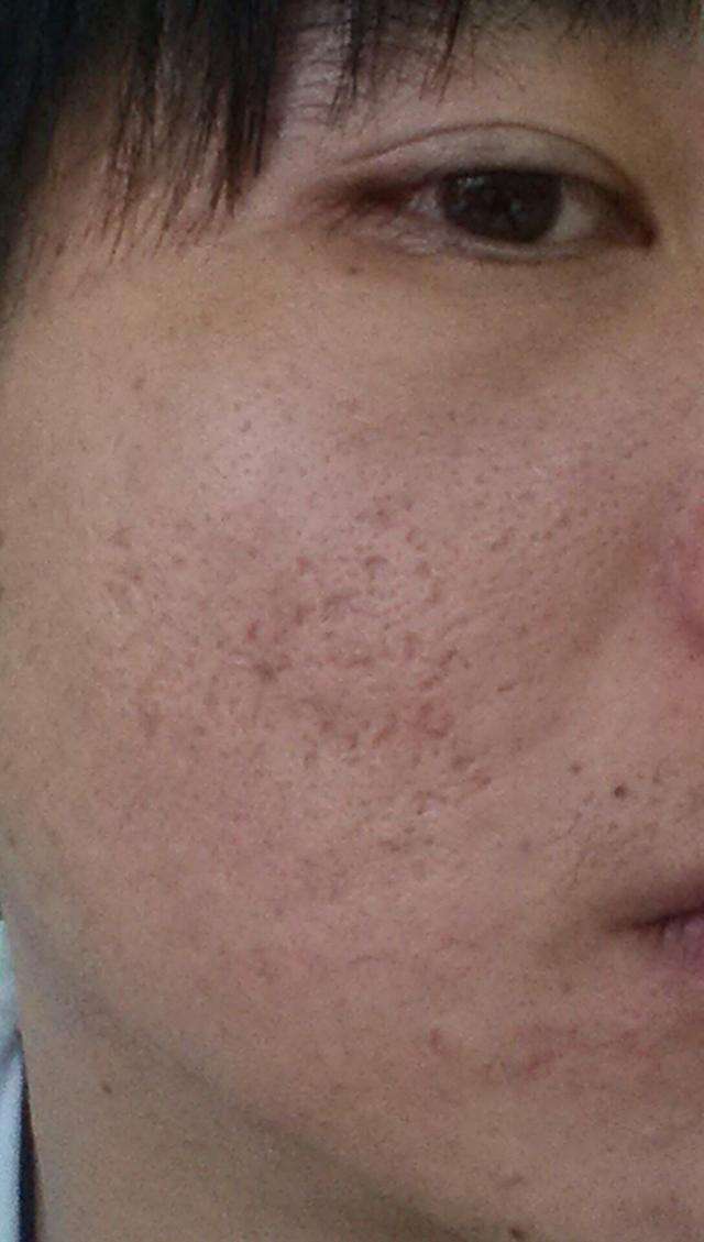 毛孔粗大还干燥，5个源头问题需解决，让毛孔细腻又嫩滑