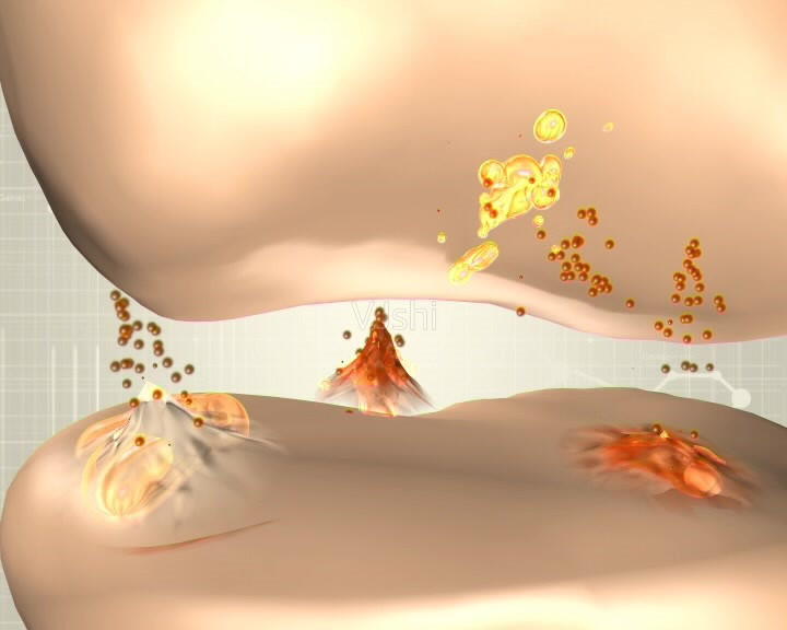 膝盖长骨刺怎么去掉骨刺,具有骨刺的骨刺是什么症状