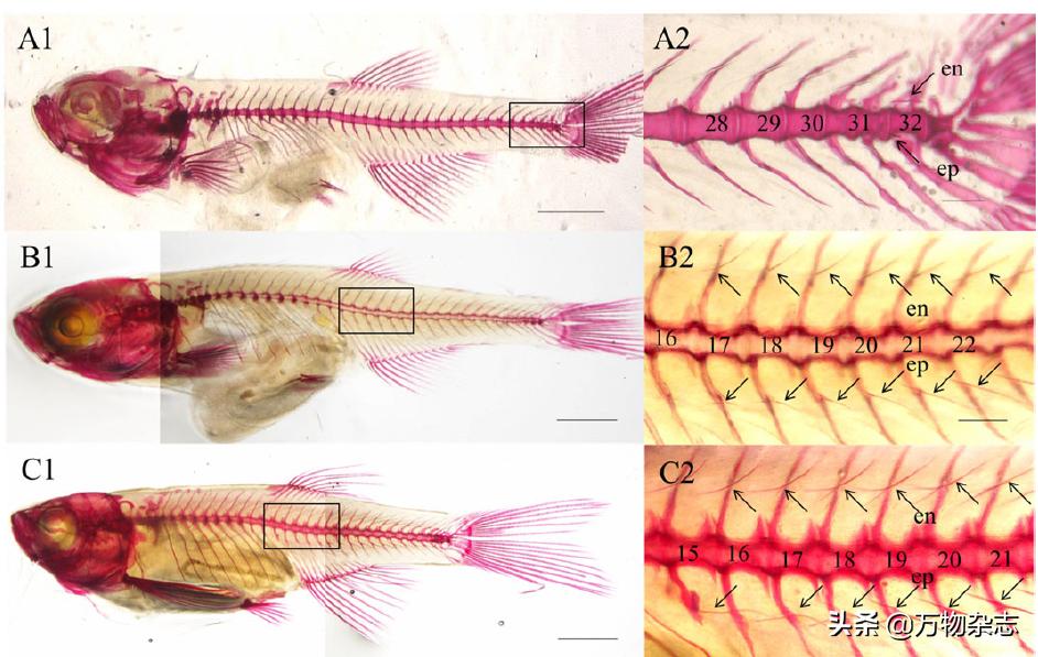 黑眼圈为什么要早睡,黑眼圈的本质是什么