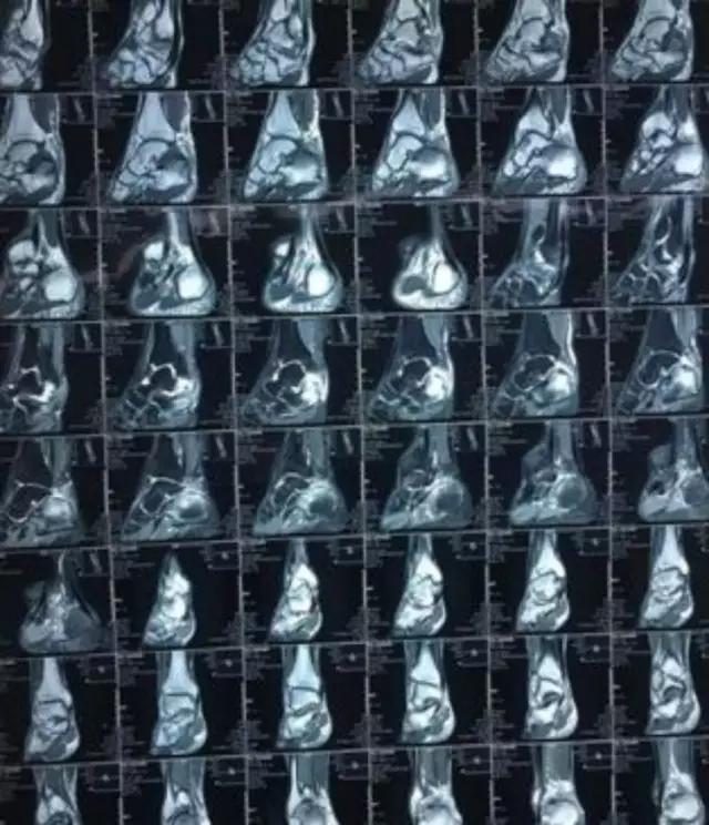 mri临床医师必读电子书,临床医生如何读mri