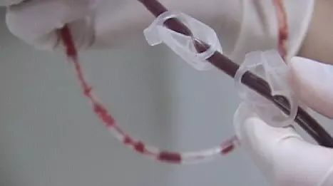 自存脐带血的价值不应被盲目否定 (科学认识自存脐带血)