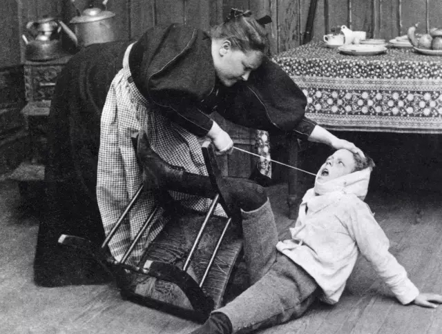 以前是怎么拔牙的,以前拔牙怎么拔的