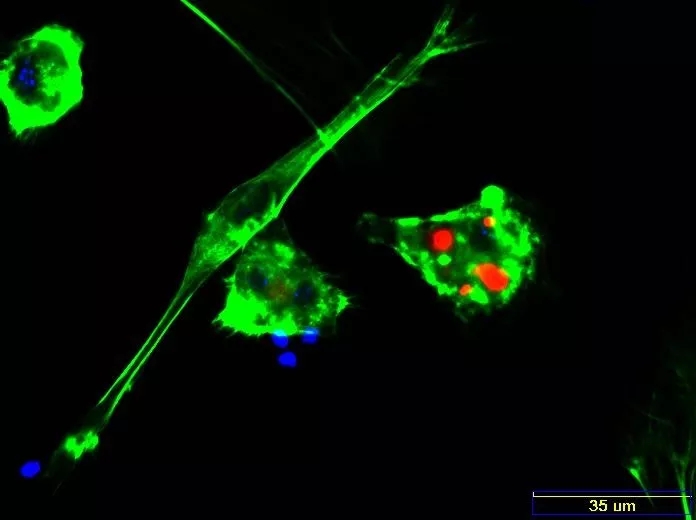 女性中风偏瘫恢复,45岁女子中风后遗症