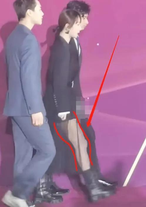 盘点明星红毯尴尬名场面,暴露身材的缺陷