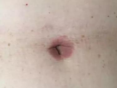 小洞不补,大洞吃苦,这个“补丁”必须打