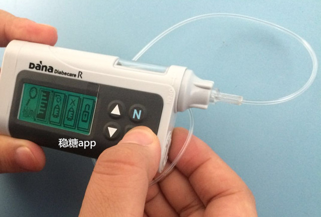 胰岛素泵怎么根据血糖调节胰岛素,胰岛素泵使用调节血糖技巧