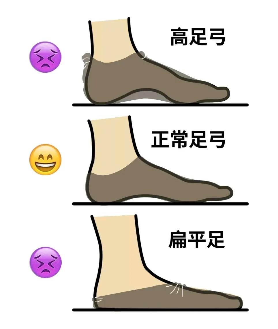 穿袜子走几步路就掉怎么处理,走路袜子总往鞋里脱小妙招