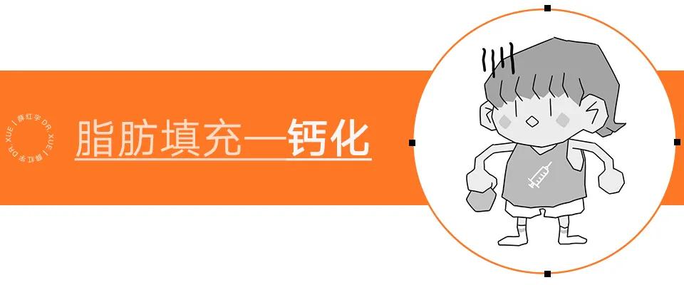 自体脂肪移植后的图片,自体脂肪移植丰胸丰臀