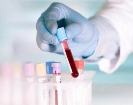 中国人比熊猫血更稀有的血型,比熊猫血还珍稀的血型是什么