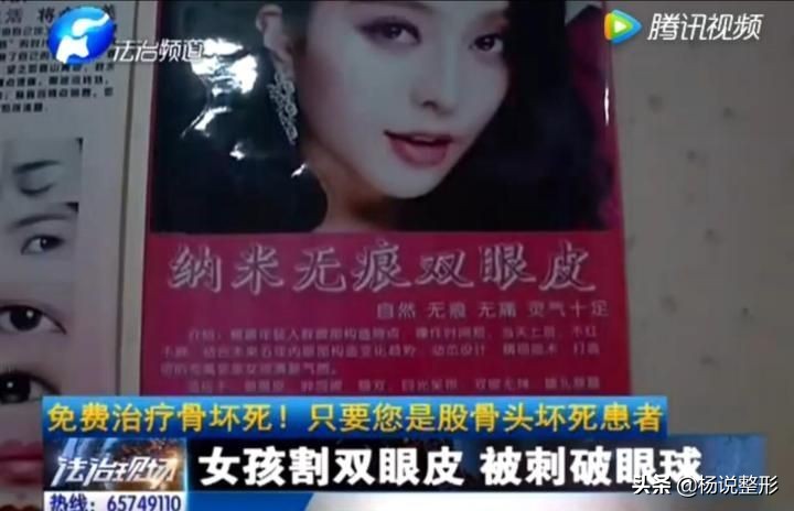 割双眼皮一定好看吗,割双眼皮真的好看吗